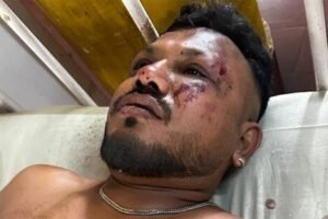 Miracle on AI 171: The Sole Survivor's Harrowing Tale