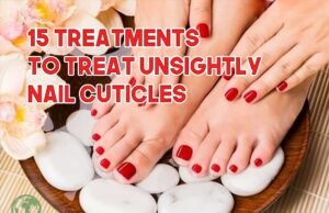 Nails Care – 15 Treatments to Treat Unsightly Nails Cuticles